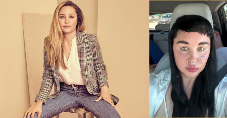 Amanda Bynes Clarifies Cosmetic Surgery Amidst Speculation, No Lobotomy, Just Blepharoplasty